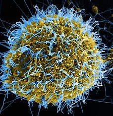 Ebola: Understanding the Virus, Outbreaks, Prevention, and Treatment