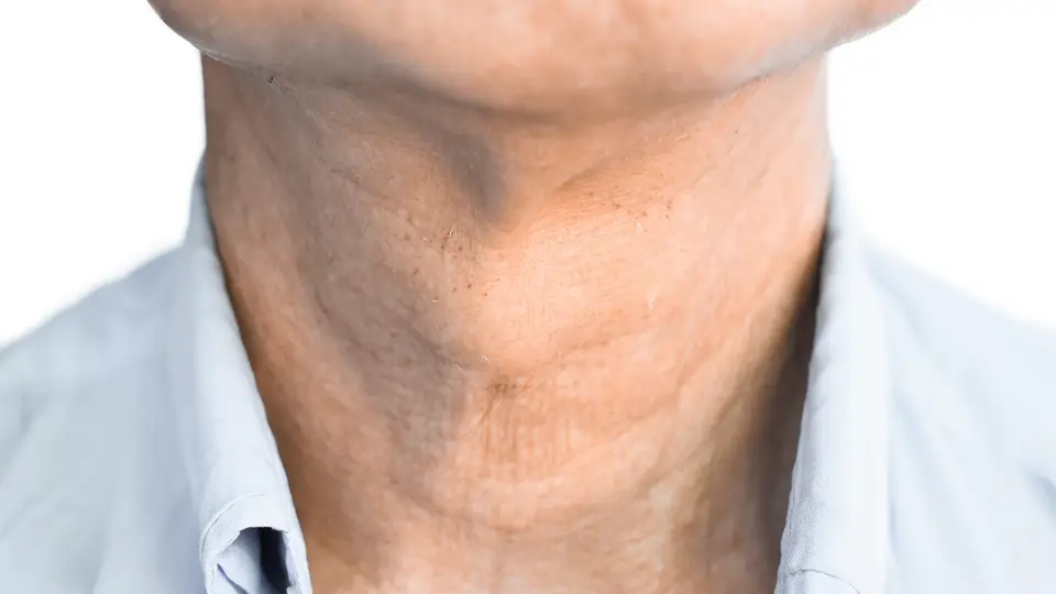 Hypothyroidism: Understanding Causes, Symptoms, and Treatment